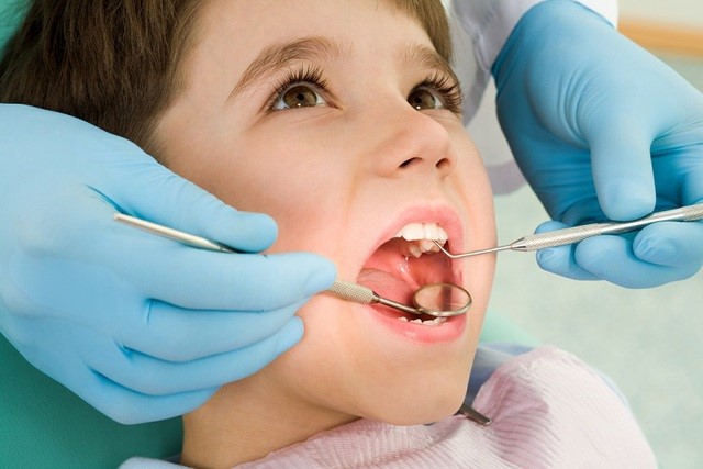 SÂU RĂNG Ở TRẺ EM: DẤU HIỆU NHẬN BIẾT, NGUYÊN NHÂN VÀ ĐIỀU TRỊ