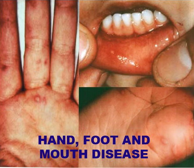 chantaymieng1.jpg chantaymieng1.jpg