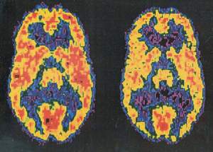 nao-nguoi-nghien-cocain.jpg nao-nguoi-nghien-cocain.jpg