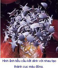 tangtieucau.jpg