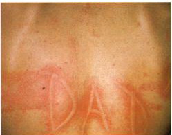 meday3.jpg meday3.jpg