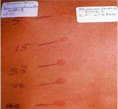 meday4.jpg meday4.jpg