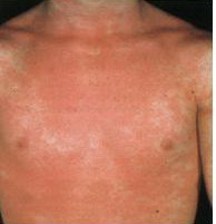 meday5.jpg meday5.jpg