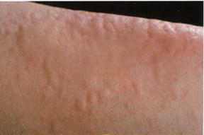 meday6.jpg meday6.jpg