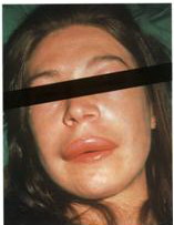 meday8.jpg meday8.jpg