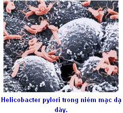 helicobacter.jpg