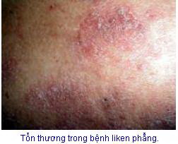 thuoc.1.jpg