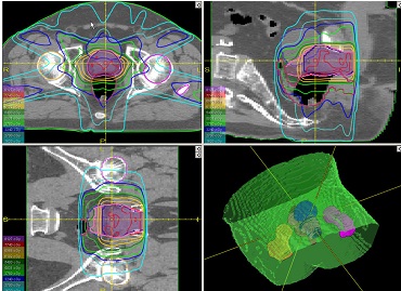 k_ttl1.jpg k_ttl1.jpg