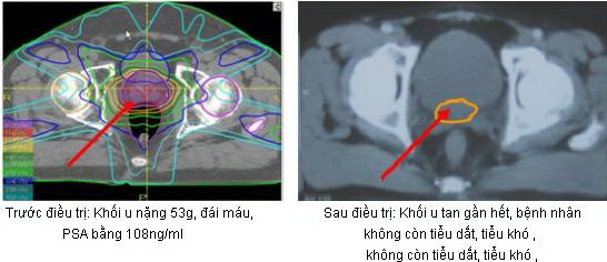 k_ttl2.jpg k_ttl2.jpg