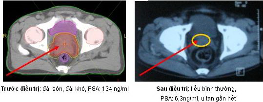 k_ttl3.jpg k_ttl3.jpg