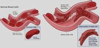 hc-hinh-liem-2.jpg