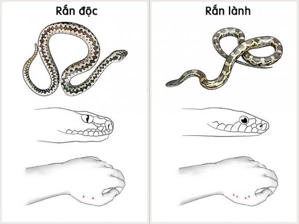so-cuu-ran-can3.jpg