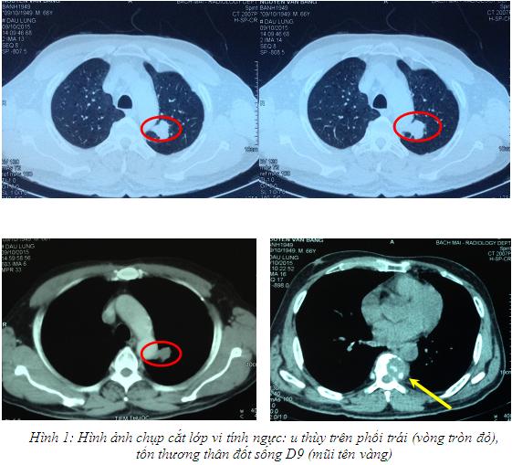 hinh_1.jpg hinh_1.jpg