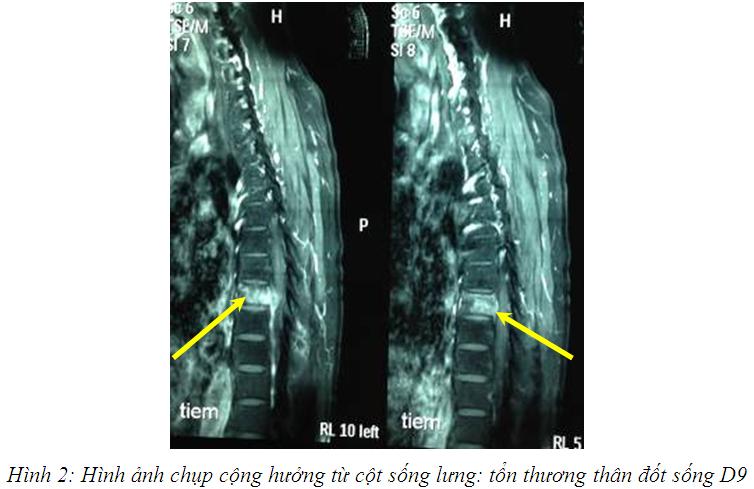 hinh_2.jpg hinh_2.jpg