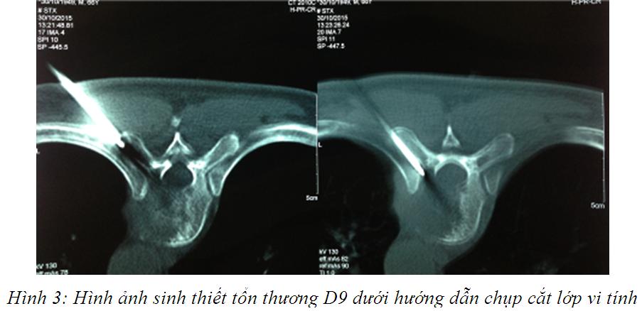 hinh_3.jpg hinh_3.jpg