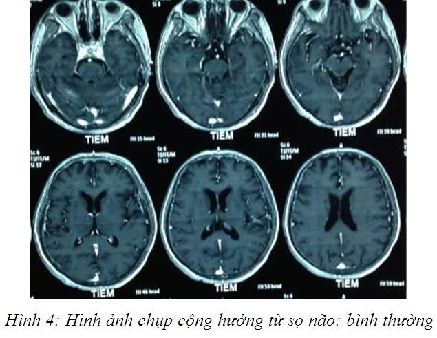 hinh_4.jpg hinh_4.jpg