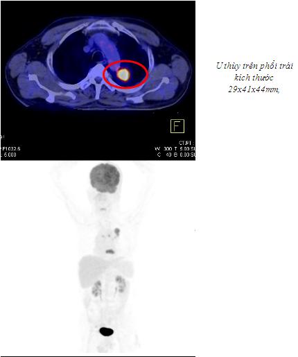 hinh_5a.jpg hinh_5a.jpg