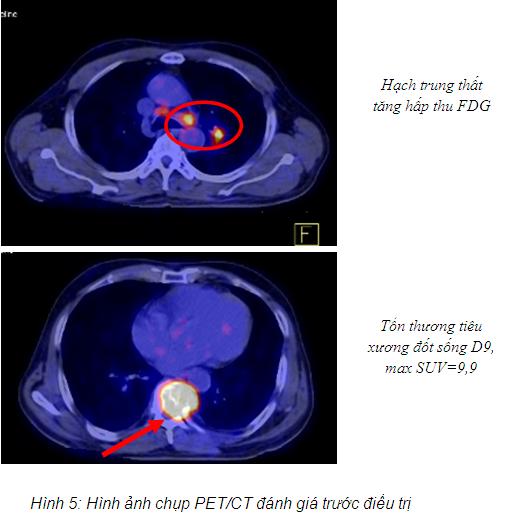 hinh_5b.jpg hinh_5b.jpg