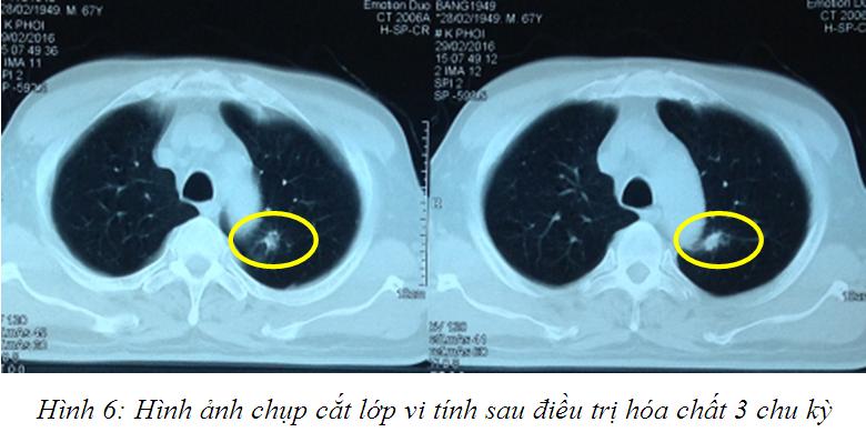 hinh_6.jpg hinh_6.jpg