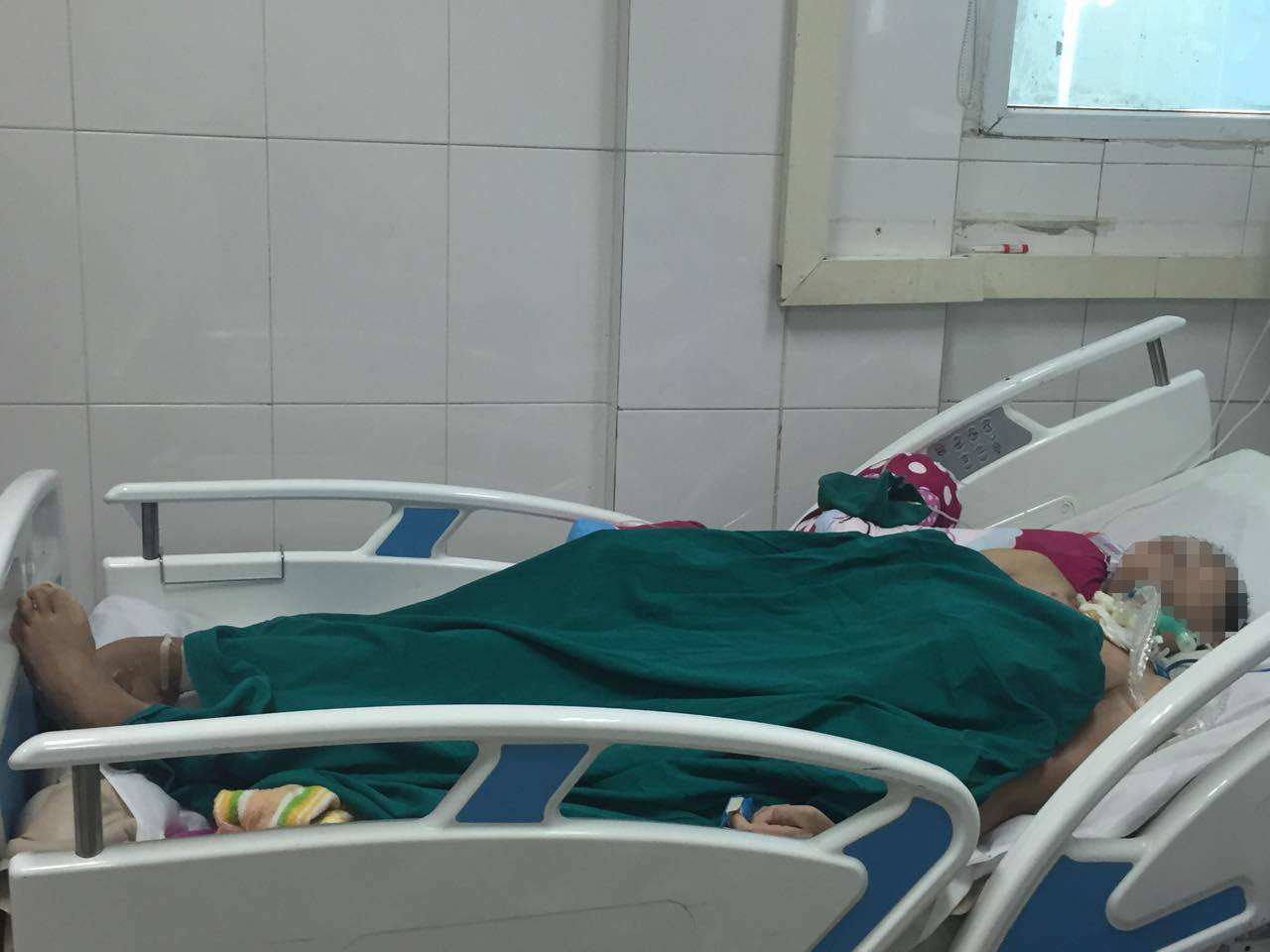 tu-vong-vi-an-mat-coc-de-chua-viem-ganbgan-b.jpg tu-vong-vi-an-mat-coc-de-chua-viem-ganbgan-b.jpg