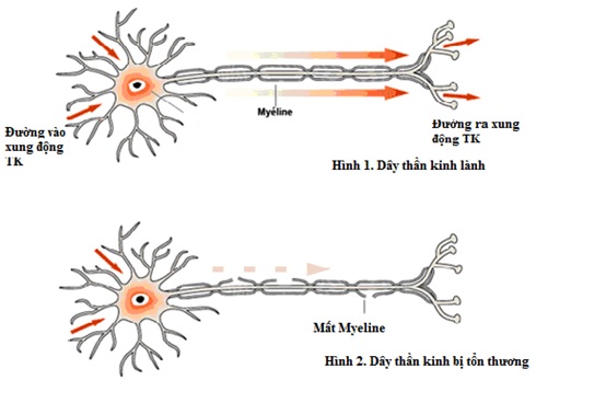 liet_co_tuc_thoi.jpg liet_co_tuc_thoi.jpg