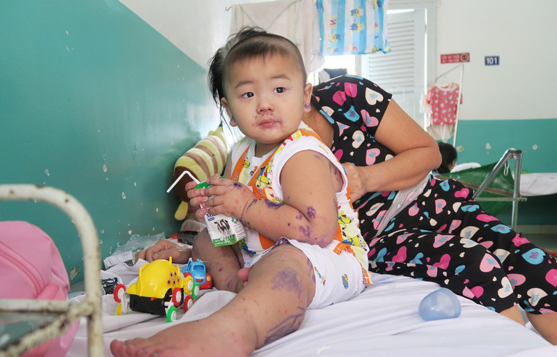 ttxvnbenhtaychanmiengvaomuataikhuvucphianam1513314604081746 15688554483991955194321