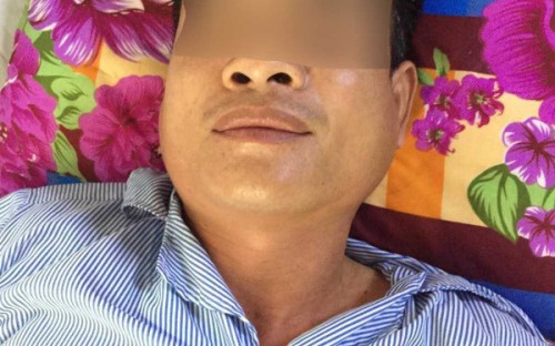 ca nha mac benh quai bi