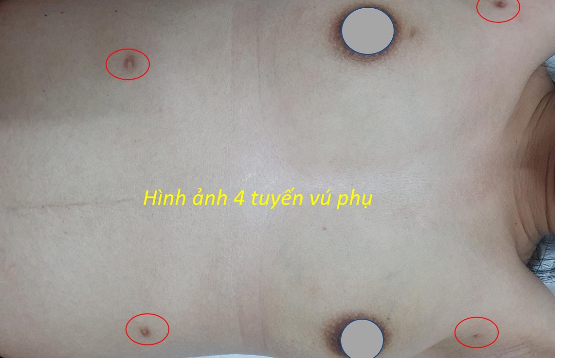 tuyen vu phu2 2022.jpg