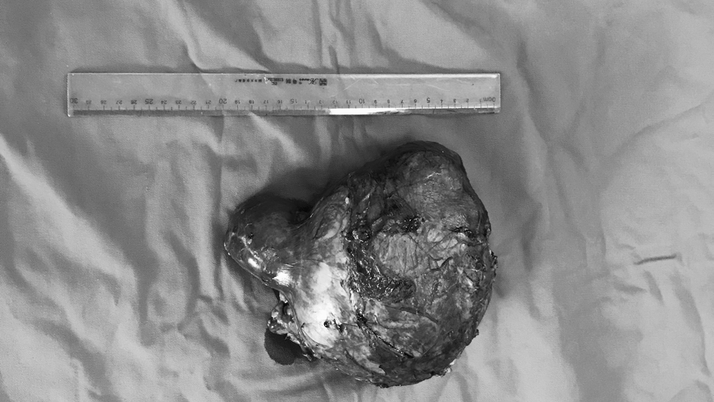 286 u than bn 6 tuoi zavr