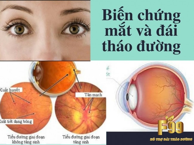 590d800910a82 1494056969