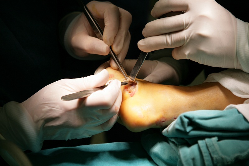 phau thuat cho chau Hoai