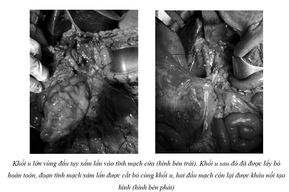 95ee90eb709fbec1e78e