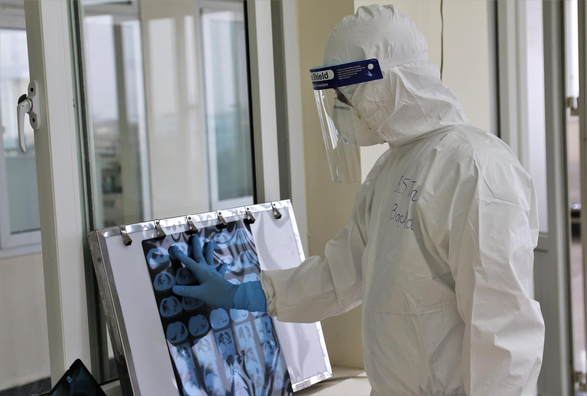 bac si trong vung dich covid 19 que huong can la chung toi len duong2