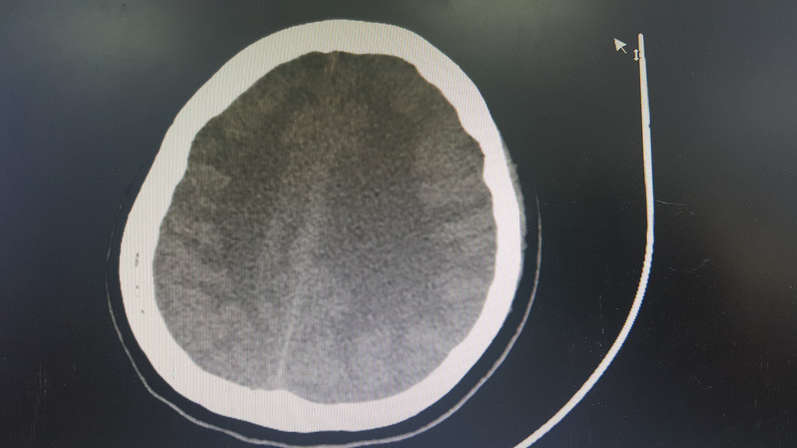 3c53d94cbc9a7ec4278b