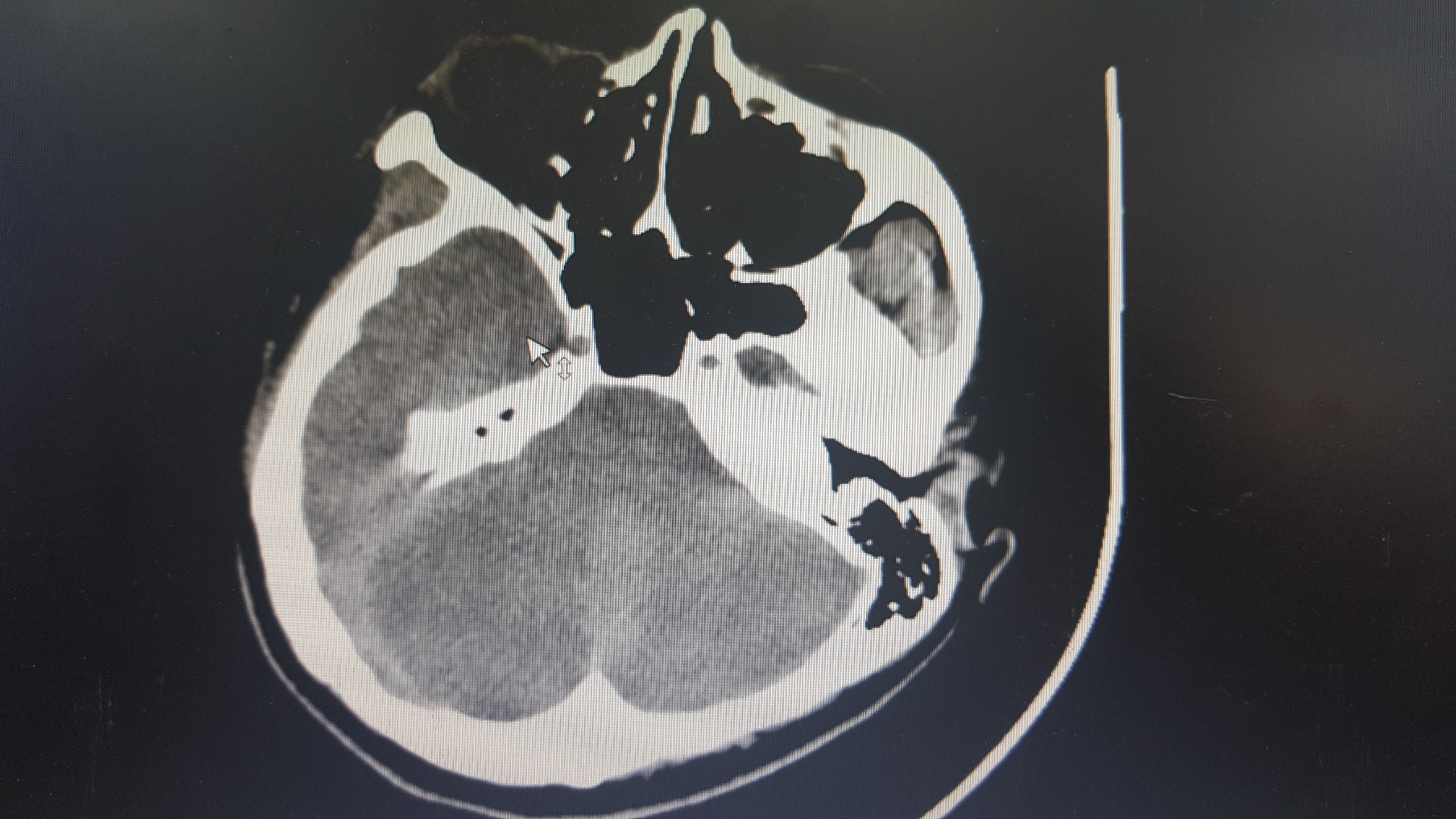 5a914d8d285bea05b34a