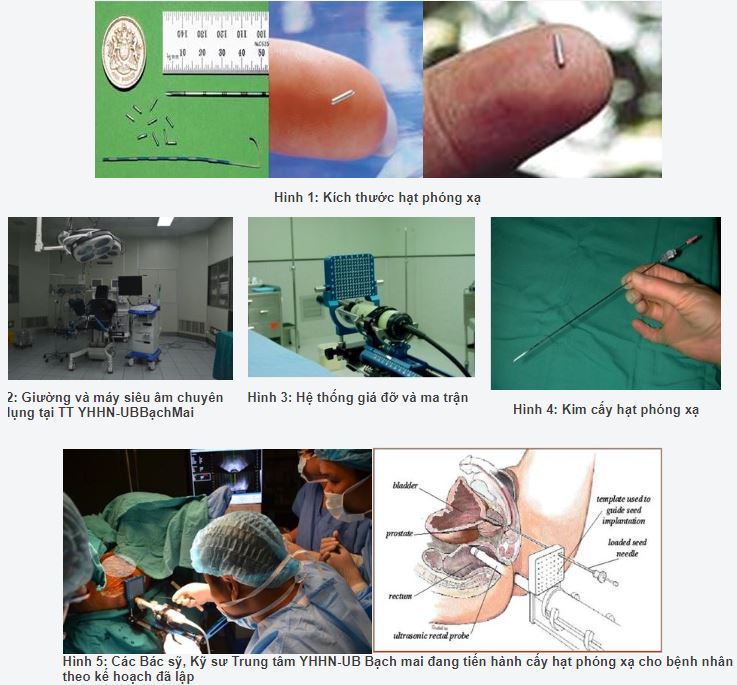 052443 alobacsi cay hat phong xa dieu tri ung thu tuyen tien liet