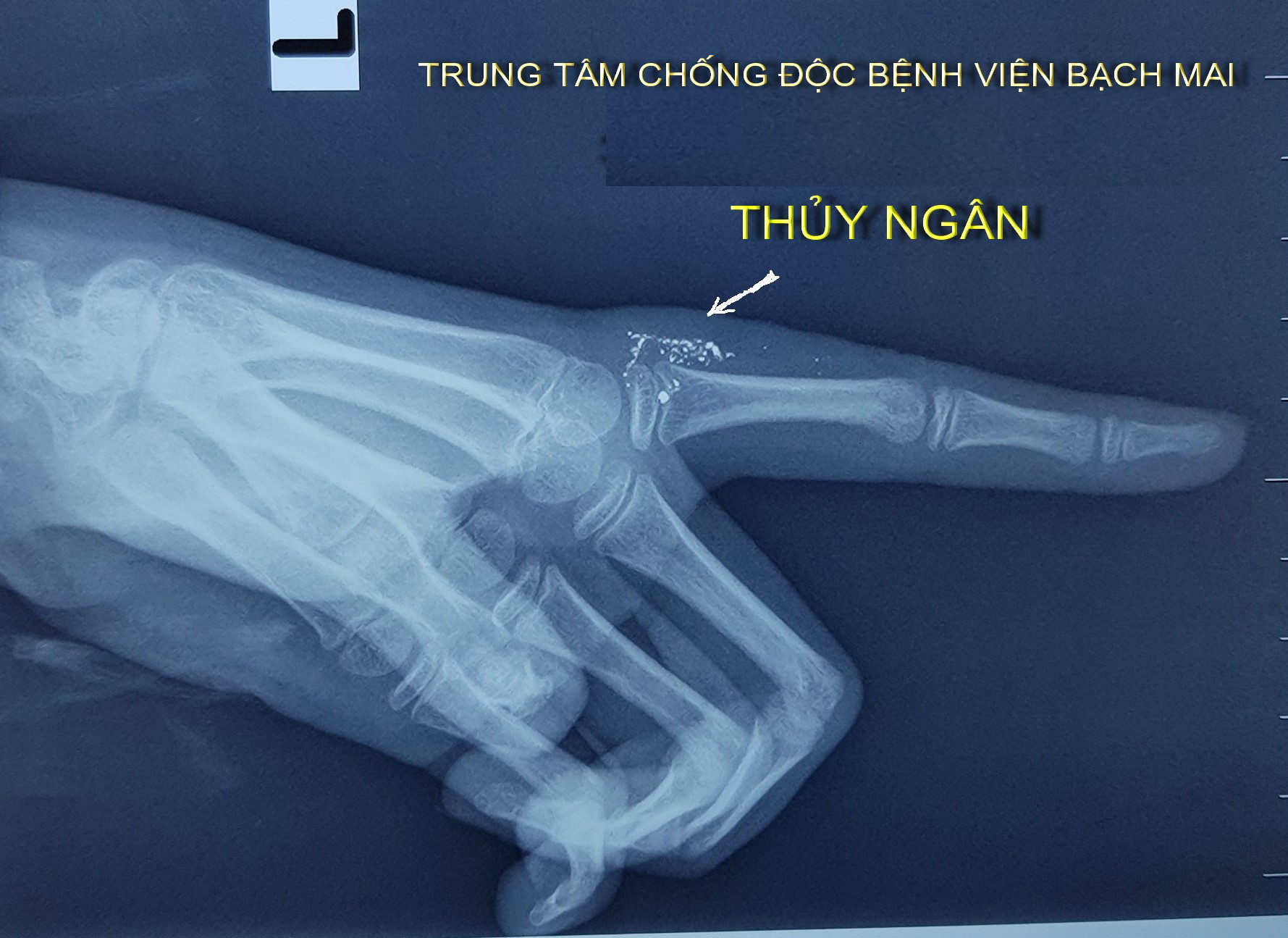 thuy ngan 2