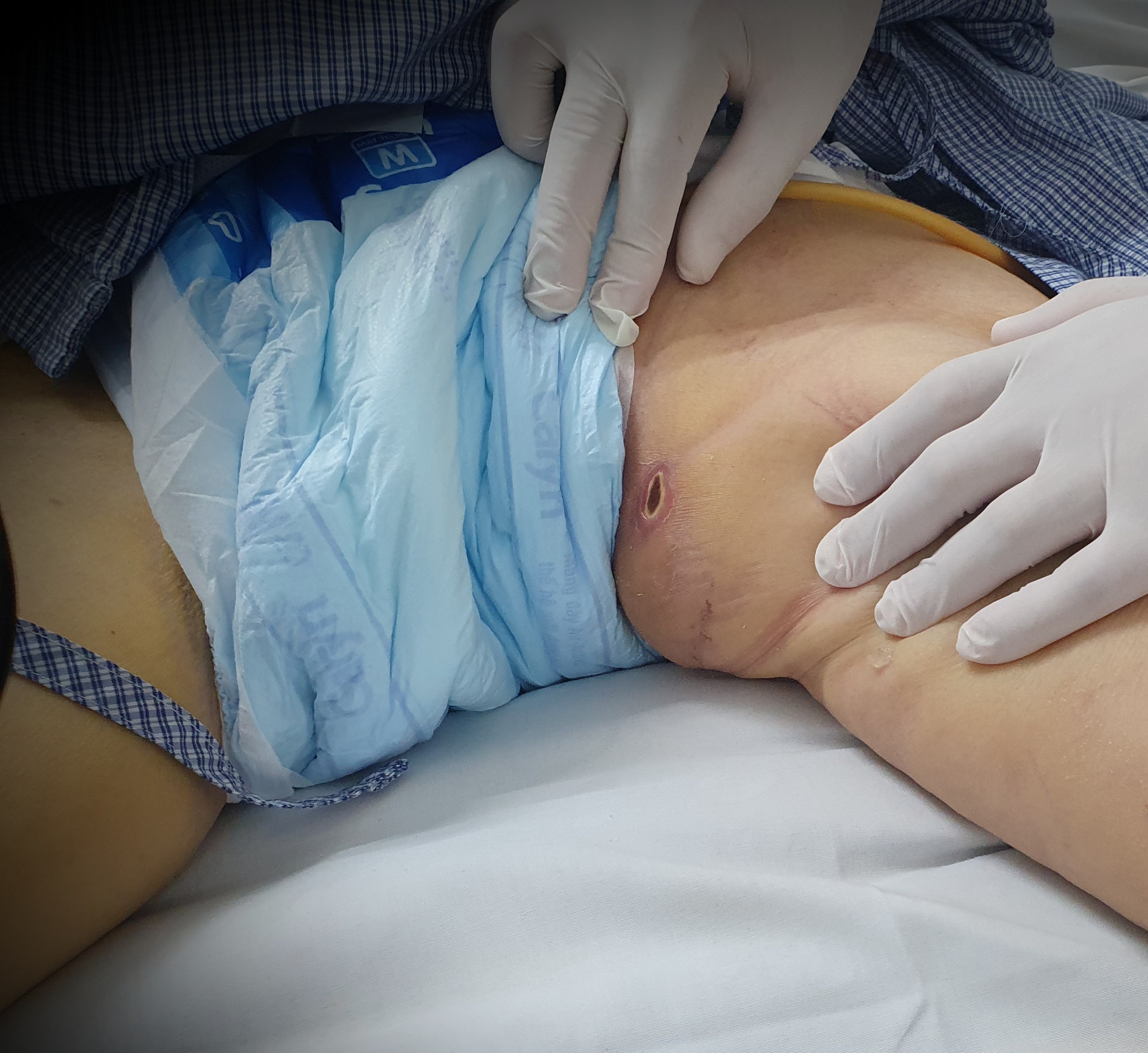 vet loet tren vung ben o bn sot mo