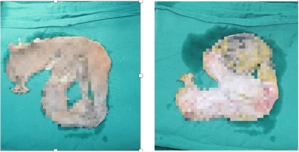 z4513354488984 92b91aa5f1b00157f085b1b39017ede8