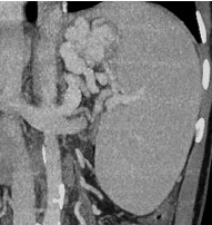 nut mach xuat huyet3