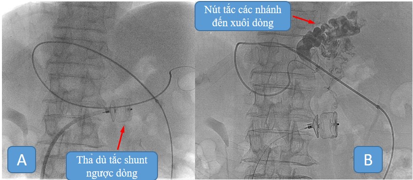 nut mach xuat huyet 5