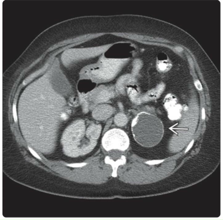 z3119587485412 686628d16718952181583f4ca32c49aa