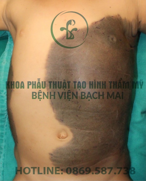 anh bai no vi khong lo