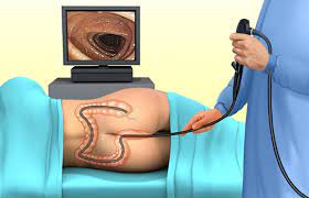 anh minh hoa noi soi dai trang