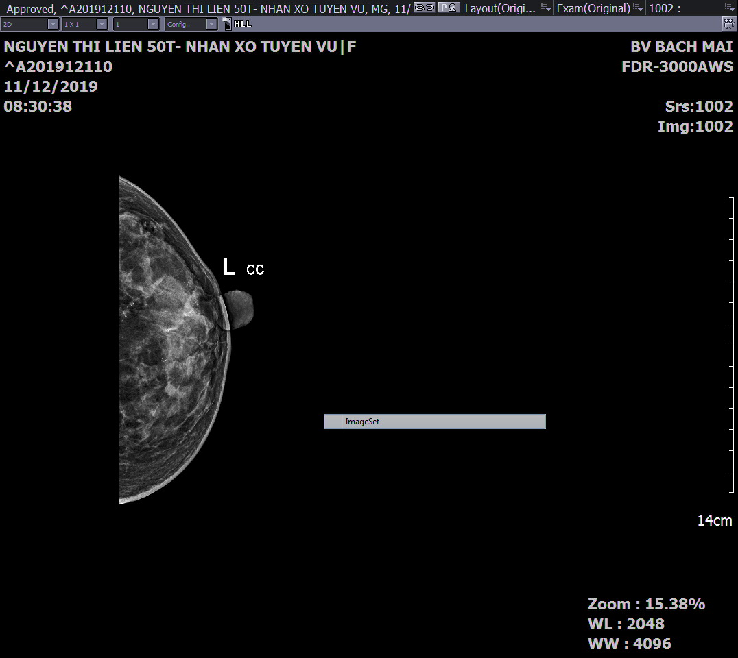 h2 bai sinh thiet vu