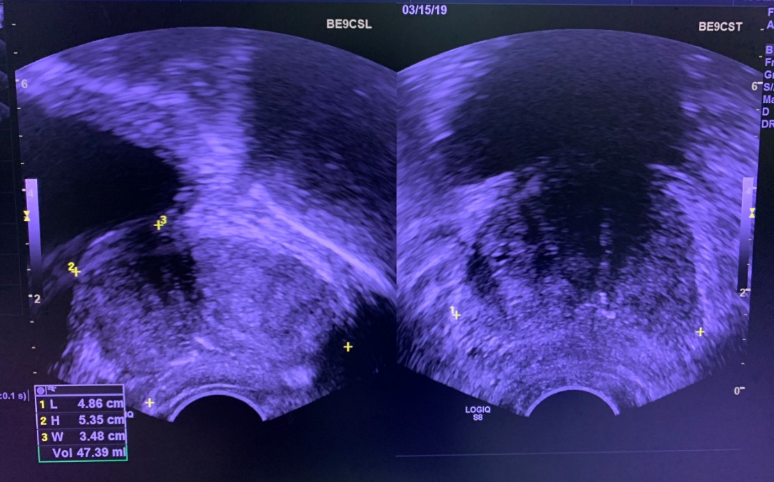 sinh thiet tuyen tien liet duoi dau do truc trang