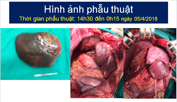 hinh anh phau thuat