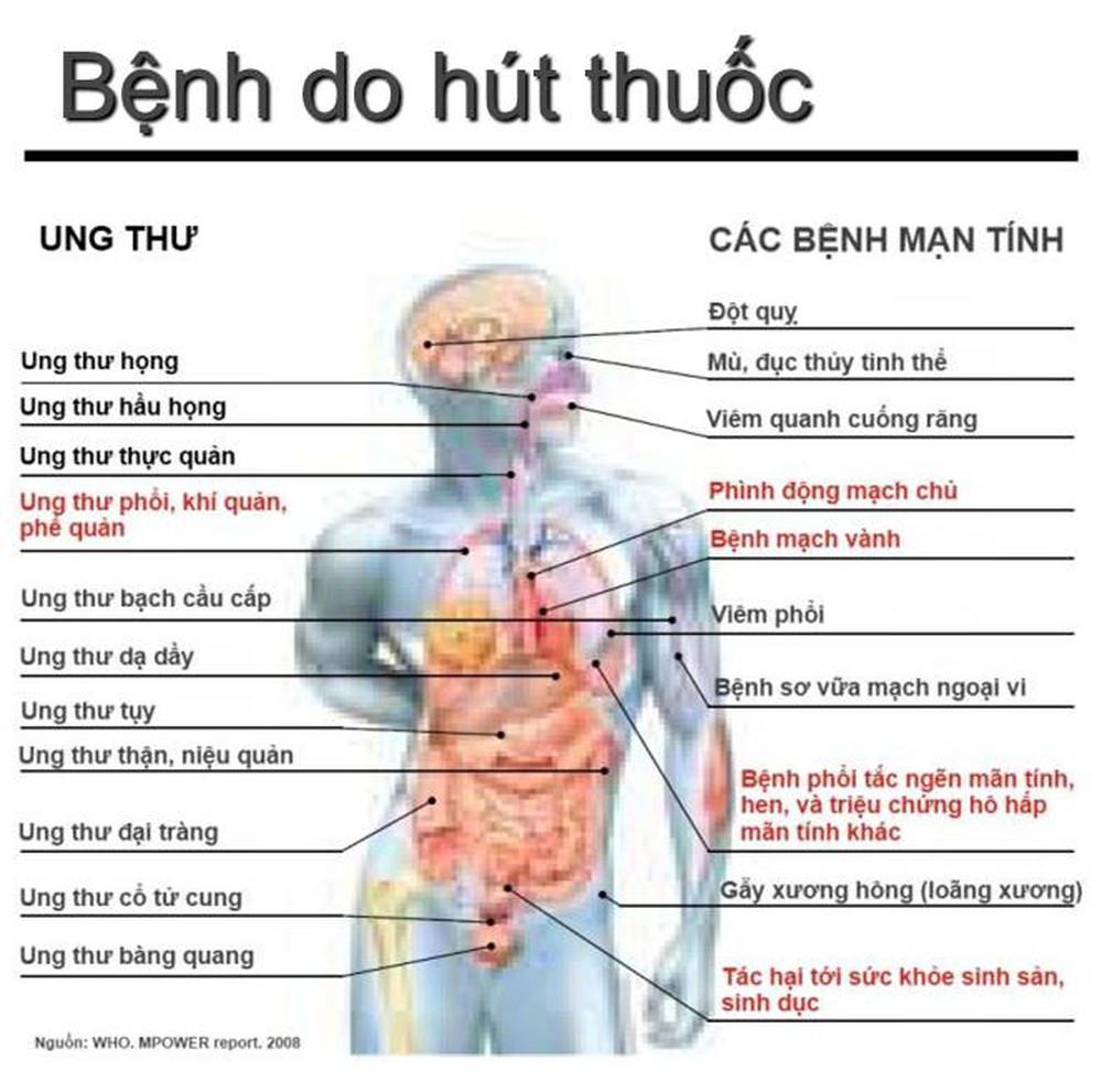 benh do hut thuoc